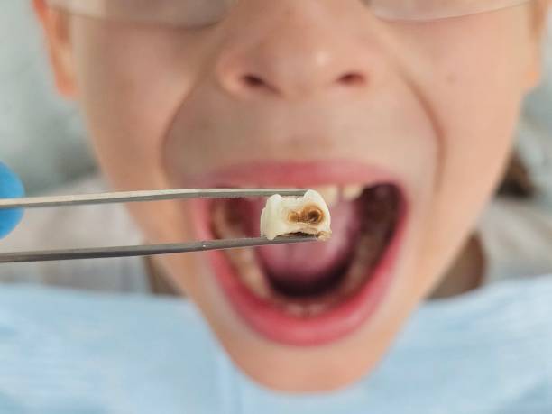 Best Cracked Tooth Emergency Dentist  in Cambridge Springs, PA