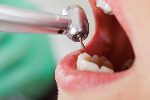 Best Emergency Dental Filling Replacement  in Cambridge Springs, PA